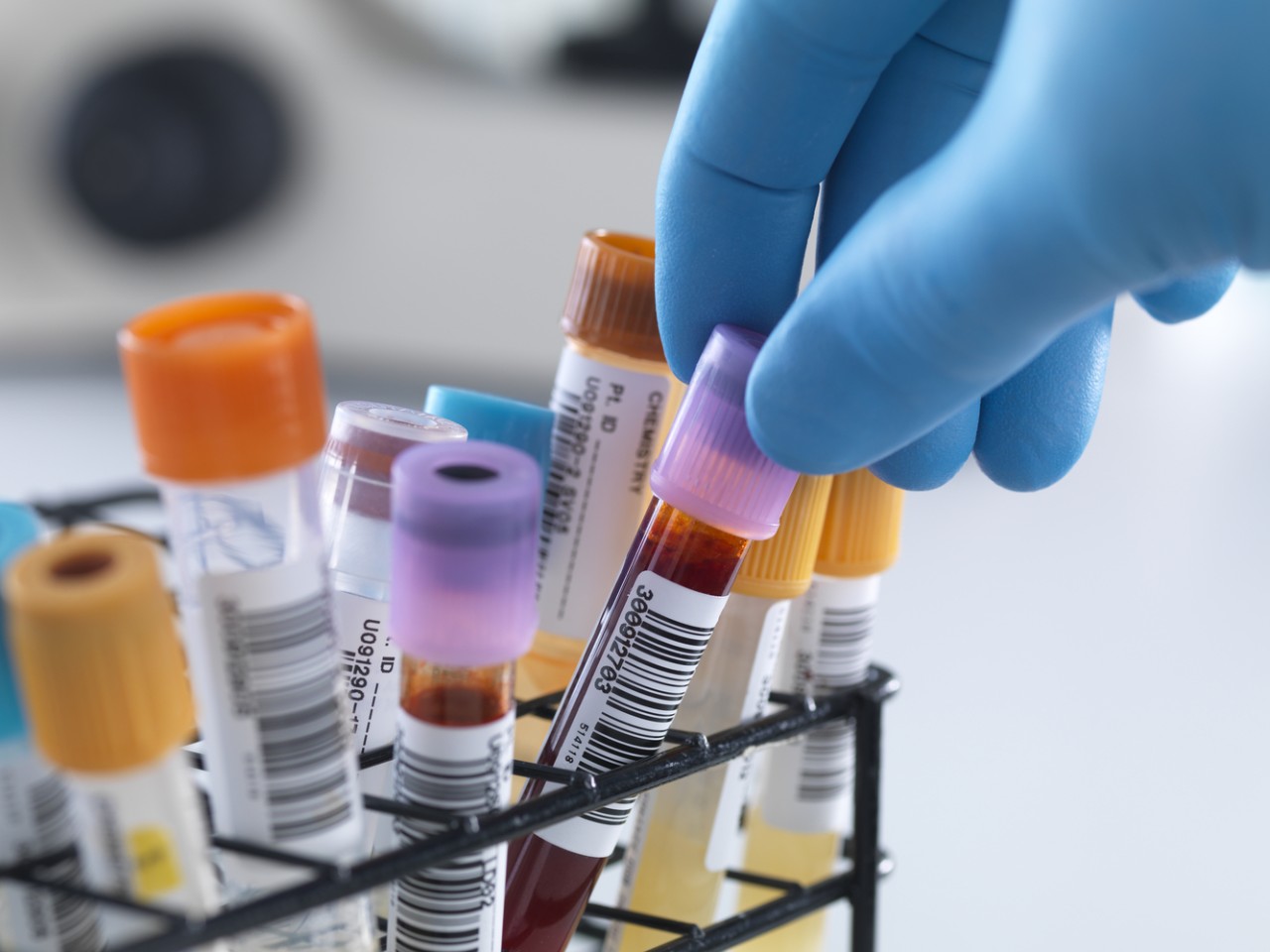 “溶出”还是“BE”，何为临床疗效“金尺度”