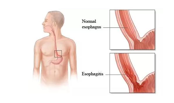 首页-BB贝博艾弗森公司官网