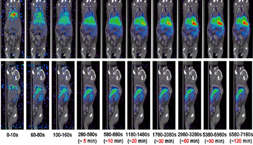 BB贝博PET/CT分子影像技术平台
