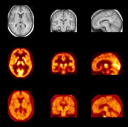 药物在幼鼠腹腔的动态散布和药物在脑的区域散布