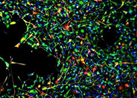 世界初创：药物将干细胞疏导至受损部位，提高其愈合能力！