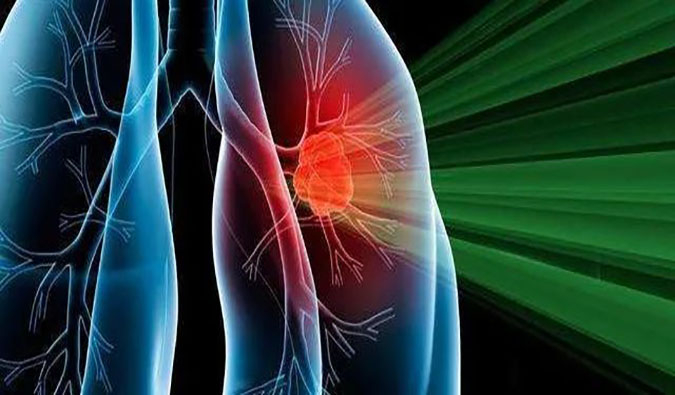 盛世泰科1类创新药物CGT-9475实现中美双报双批 | BB贝博一站式临床前生物医药研发服务平台助力