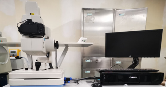 数字眼底造影查抄仪