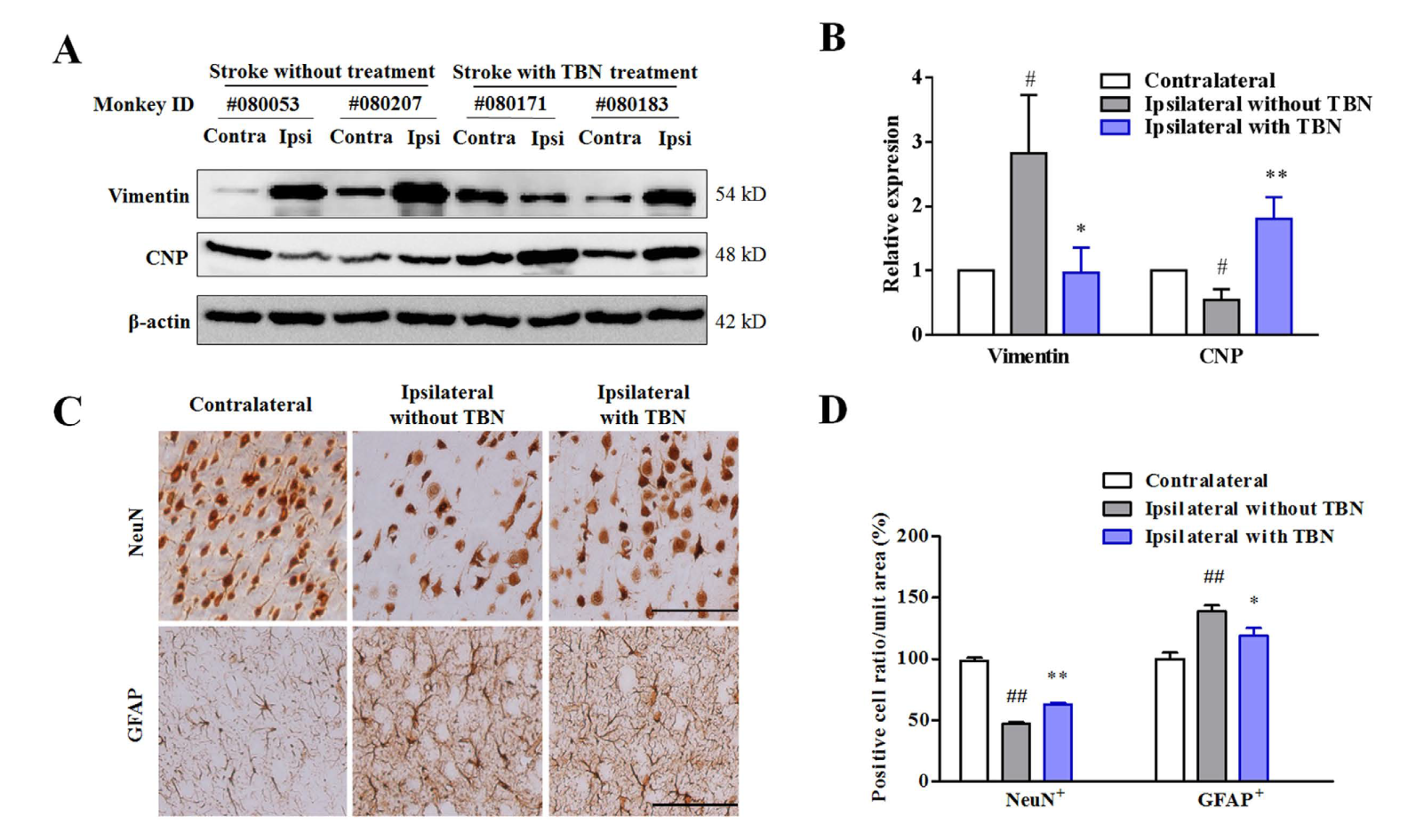 TBN是一种医治缺血性卒中的新型临床候选药物，本钻研中TBN通过BB贝博合成